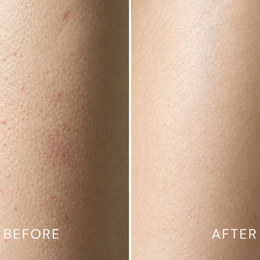 Ynari Glycolic Acid Exfoliating Body Stick