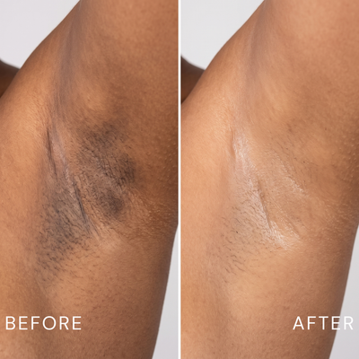 Ynari Glycolic Acid Exfoliating Body Stick